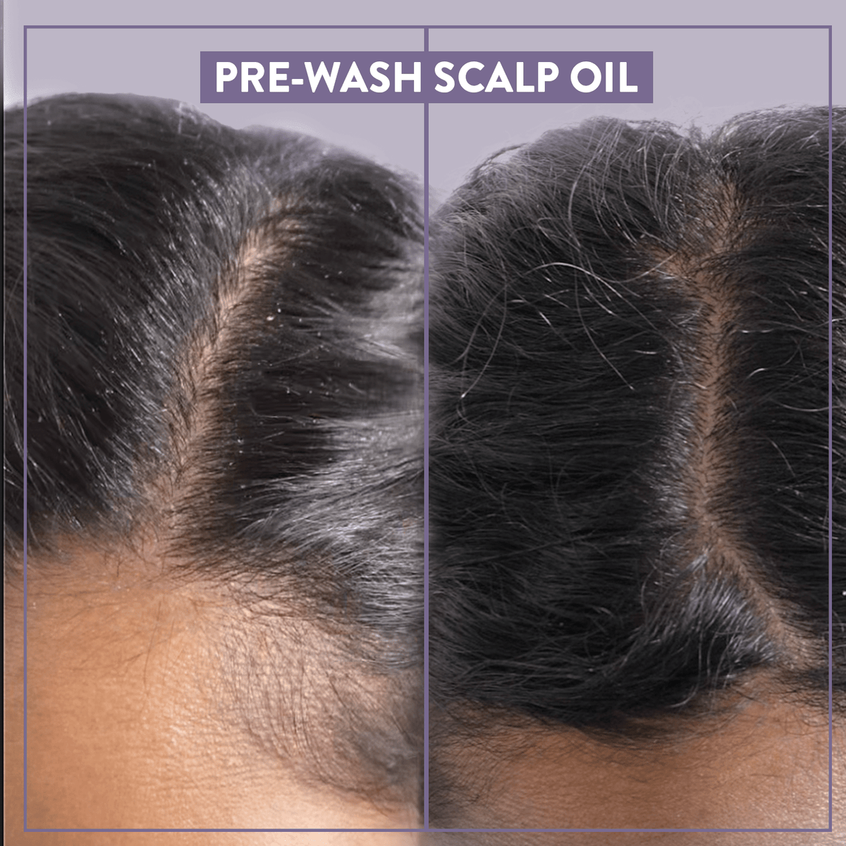 damp scalp oil application technique before and after